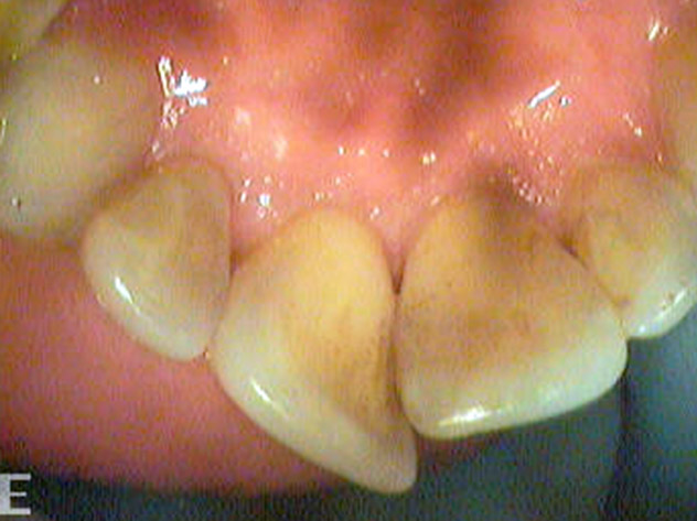https://www.dottorgiuseppebellinvia.info/wp-content/uploads/2021/05/dentista-firenze-giuseppe-bellinvia-paradontologia-3.jpg