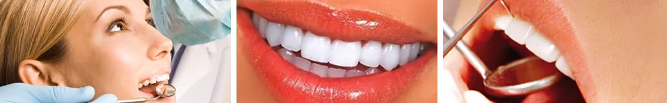https://www.dottorgiuseppebellinvia.info/wp-content/uploads/2021/06/dentista-firenze-giuseppe-bellinvia-sbiancamento-denti2.jpg